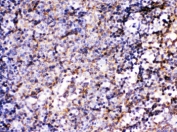 IHC testing of FFPE mouse lymph node with BCAR3 antibody. HIER: Boil the paraffin sections in pH 6, 10mM citrate buffer for 20 minutes and allow to cool prior to staining.