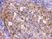 IHC testing of FFPE human tonsil with BCAR3 antibody. HIER: Boil the paraffin sections in pH 6, 10mM citrate buffer for 20 minutes and allow to cool prior to staining.