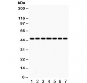 Western blot testing of 1) rat lung, 2) rat kidney, 3) rat brain, 4) human HeLa, 5) SMMC, 6) A549 and 7) mouse NIH3T3 lysate with IDH1 antibody. Predicted/observed molecular weight ~47 kDa.