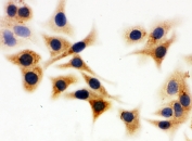 ICC staining of FFPE human A549 cells with IDH1 antibody. HIER: Boil the paraffin sections in pH 6, 10mM citrate buffer for 20 minutes and allow to cool prior to staining.