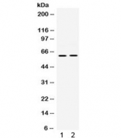 Western blot testing of 1) rat brain and 2) mouse brain lysate with PAK3 antibody. Expected/observed molecular weight ~62 kDa.