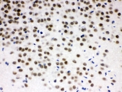 IHC testing of FFPE rat brain with ZBTB7A antibody. HIER: Boil the paraffin sections in pH 6, 10mM citrate buffer for 20 minutes and allow to cool prior to staining.