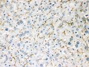 IHC testing of FFPE mouse liver with ABCB11 antibody. HIER: Boil the paraffin sections in pH 6, 10mM citrate buffer for 20 minutes and allow to cool prior to staining.