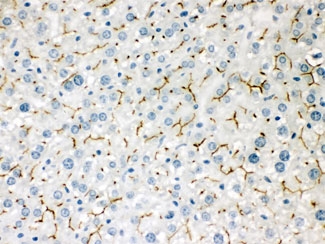 IHC testing of FFPE mouse liver with ABCB11 antibody. HIER: Boil the paraffin sections in pH 6, 10mM citrate buffer for 20 minutes and allow to cool prior to staining.