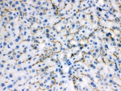 IHC testing of FFPE rat liver with ABCB11 antibody. HIER: Boil the paraffin sections in pH 6, 10mM citrate buffer for 20 minutes and allow to cool prior to staining.