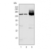 Western blot testing of 1) human HCCT 2) rat liver and 3) mouse liver lysate with ABCB11 antibody. Expected/observed molecular weight ~146 kDa.