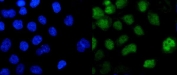 Immunofluorescent staining of FFPE human A431 cells with Pokemon antibody (green) and DAPI nuclear stain (blue). HIER: steam section in pH6 citrate buffer for 20 min.