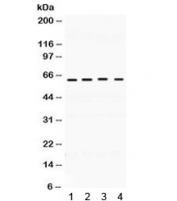 Western blot testing of 1) rat brain, 2) rat testis, 3) human MCF7 and 4) human HeLa lysate with BAG3 antibody. Predicted molecular weight ~62 kDa but can be observed at 75~80 kDa.
