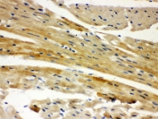 IHC testing of FFPE mouse heart and AIF antibody. HIER: Boil the paraffin sections in pH 6, 10mM citrate buffer for 20 minutes and allow to cool prior to staining.