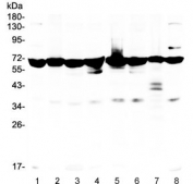 Western blot testing of human 1) placenta, 2) A549, 3) PC-3, 4) K562, 5) Caco-2, 6) HeLa, 7) HL60 and 8) U-87 MG lysate with AIF antibody. Expected molecular weight ~67 kDa.