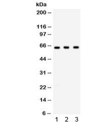 Western blot testing of 1) rat spleen, 2) mouse testis, 3) human SW620 lysate with Chk2 antibody. Expected molecular weight: ~61 kDa.~