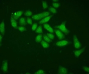 IF/ICC staining of FFPE human Hep2 cells with SOD1 antibody. HIER: steam section in pH6 citrate buffer for 20 min.