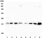 Western blot testing of human 1) placenta, 2) HeLa, 3) MDA-MB-231, 4) SW620, 5) A549, 6) HepG2, 7) Jurkat and 8) K562 lysate with SOD1 antibody. Predicted molecular weight ~16 kDa.
