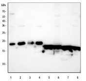 Western blot testing of human 1) placenta, 2) HeLa, 3) MDA-MB-231, 4) SW620, 5) A549, 6) HepG2, 7) Jurkat and 8) K562 lysate with SOD1 antibody. Predicted molecular weight ~16 kDa.