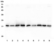Western blot testing of rat 1) brain, 2) spleen, 3) liver, 4) kidney and mouse 5) brain, 6) spleen, 7) liver, 8) kidney and 9) HEPA1-6 lysate with SOD1 antibody. Predicted molecular weight ~16 kDa.