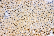 IHC staining of FFPE mouse liver with SOD1 antibody. HIER: boil tissue sections in pH 8 EDTA for 20 min and allow to cool before testing.