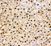 IHC staining of FFPE rat liver with SOD1 antibody. HIER: boil tissue sections in pH 8 EDTA for 20 min and allow to cool before testing.