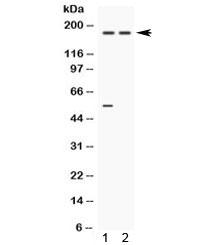 Western blot testing of human 1) 22RV1 and 2) A549 cell lysate with Ceruloplasmin antibody. Expected molecular weight ~130 kDa. The ~180 kDa may represent the glycosylated form of the protein.~