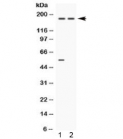 Western blot testing of human 1) 22RV1 and 2) A549 cell lysate with Ceruloplasmin antibody. Expected molecular weight ~130 kDa. The ~180 kDa may represent the glycosylated form of the protein.
