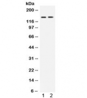 Western blot testing of 1) rat brain and 2) human HeLa lysate with c-Abl antibody. Expected molecular weight: routinely visualized at 123-150 kDa, observed here at ~150 kDa.
