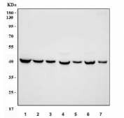 Western blot testing of 1) human HeLa 2) human HepG2, 3) human 293T, 4) rat brain, 5) rat liver, 6) mouse brain and 7) mouse liver tissue lysate with PGK antibody. Expected molecular weight ~44 kDa.