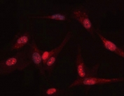 Immunofluorescent staining of FFPE human U-87 MG cells with PGK antibody. HIER: steam section in pH6 citrate buffer for 20 min.
