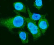 Immunofluorescent staining of FFPE human Caco-2 cells with Carbonic Anhydrase I antibody (green) and DAPI nuclear stain (blue). HIER: steam section in pH6 citrate buffer for 20 min.