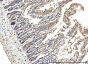 IHC staining of FFPE mouse colon tissue with Carbonic Anhydrase I antibody. HIER: boil tissue sections in pH8 EDTA for 20 min and allow to cool before testing.