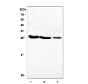 Western blot testing of 1) human HEL, 2) rat spleen and 3) mouse spleen lysate with Carbonic Anhydrase I antibody. Predicted molecular weight: ~29 kDa.