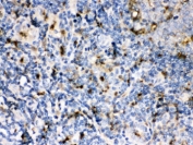 IHC testing of FFPE human tonsil with CSTA antibody. HIER: Boil the paraffin sections in pH 6, 10mM citrate buffer for 20 minutes and allow to cool prior to staining.