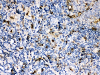 IHC testing of FFPE human tonsil with CSTA antibody. HIER: Boil the paraffin sections in pH 6, 10mM citrate buffer for 20 minutes and allow to