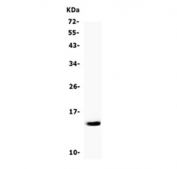 Western blot testing of human K562 cell lysate with CSTA antibody. Predicted molecular weight ~11 kDa.