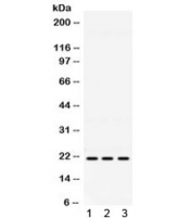 Western blot testing of 1) mouse brain, 2) human HeLa and 3) human A549 lysate with HRAS antibody. Expected/observed molecular weight ~21 kDa.