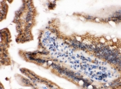 IHC staining of FFPE mouse intestine with HRAS antibody. HIER: boil tissue sections in pH6, 10mM citrate buffer, for 20 min and allow to cool before testing.