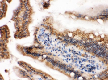 IHC staining of FFPE mouse intestine with HRAS antibody. HIER: boil tissue sections in pH6, 10mM citrat