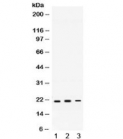 Western blot testing of 1) rat brain, 2) mouse brain, and 3) mouse HEPA lysate with HRAS antibody. Expected/observed molecular weight ~21 kDa.