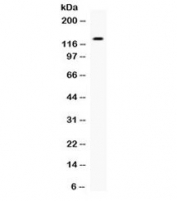 Western blot testing of human 22RV1 cell lysate with EGF antibody. Expected molecular weight: 134-160 kDa.