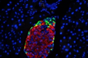 Immunofluorescent staining of mouse pancreas with GLP-1 antibody (green) at 1ug/ml and DAPI nuclear stain (blue). HIER: Boil the paraffin sections in pH 6, 10mM citrate buffer for 20 minutes and allow to cool prior to staining.