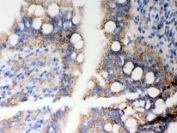 IHC testing of FFPE rat intestine with HLA-A antibody. HIER: Boil the paraffin sections in pH 6, 10mM citrate buffer for 20 minutes and allow to cool prior to staining.