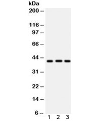 Western blot testing of 1) human U87, 2) human HepG2 and 3) mouse brain lysate with HLA-A antibody. Expected/observed molecular weight ~41 kDa.~