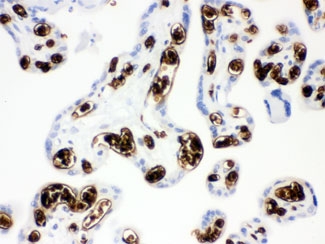 IHC testing of FFPE human placenta with Band 3 antbody. HIER: Boil the paraffin sections in pH 6, 10mM citrate buffer for 20 minutes and allow to cool prior to staining.