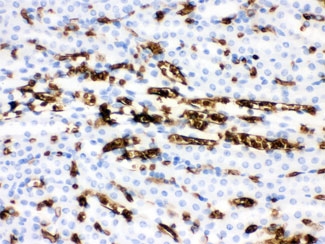 IHC testing of FFPE mouse kidney with Band 3 antbody. HIER: Boil the paraffin sections in pH 6, 10mM citrate buffer for 20 minutes and allow to cool prior to staining.