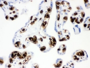 IHC testing of FFPE human placenta with Band 3 antibody. HIER: Boil the paraffin sections in pH 6, 10mM citrate buffer for 20 minutes and allow to cool prior to staining.