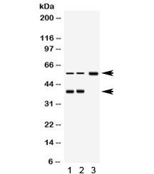 Western blot testing of 1) rat brain, 2) human RH35 and 3) MCF7 lysate with AHSG antibody. Expected molecular weight ~39/45-55 kDa (unmodified/glycosylated).