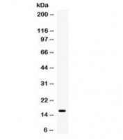 Western blot testing of human 1) placenta and 20 HCCP cell lysate with Transthyretin antibody. Expected molecular weight ~16 kDa.