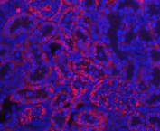 Immunofluorescent staining of FFPE rat kidney tissue with TTR antibody (red) and DAPI nuclear stain (blue). HIER: steam section in pH6 citrate buffer for 20 min.