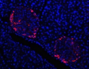 Immunofluorescent staining of FFPE mouse pancreas tissue with TTR antibody (red) and DAPI nuclear stain (blue). HIER: steam section in pH6 citrate buffer for 20 min.