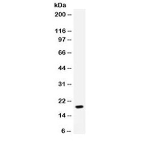 Western blot testing of human MCF7 cell lysate with NAP-2 antibody. Predicted molecular weight: 8~14 kDa.~