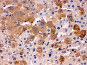 IHC testing of FFPE mouse liver with Transferrin antibody. HIER: Boil the paraffin sections in pH 6, 10mM citrate buffer for 20 minutes and allow to cool prior to staining.