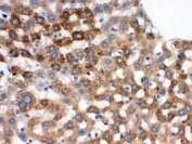 IHC testing of FFPE rat liver with Transferrin antibody. HIER: Boil the paraffin sections in pH 6, 10mM citrate buffer for 20 minutes and allow to cool prior to staining.